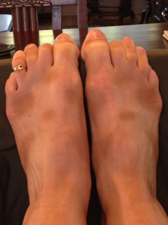 Absurd Feet